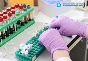 Пакет изследвания за щитовидна жлеза - TSH, FT4, TAT, MAT и TRAB от Лаборатории Кандиларов